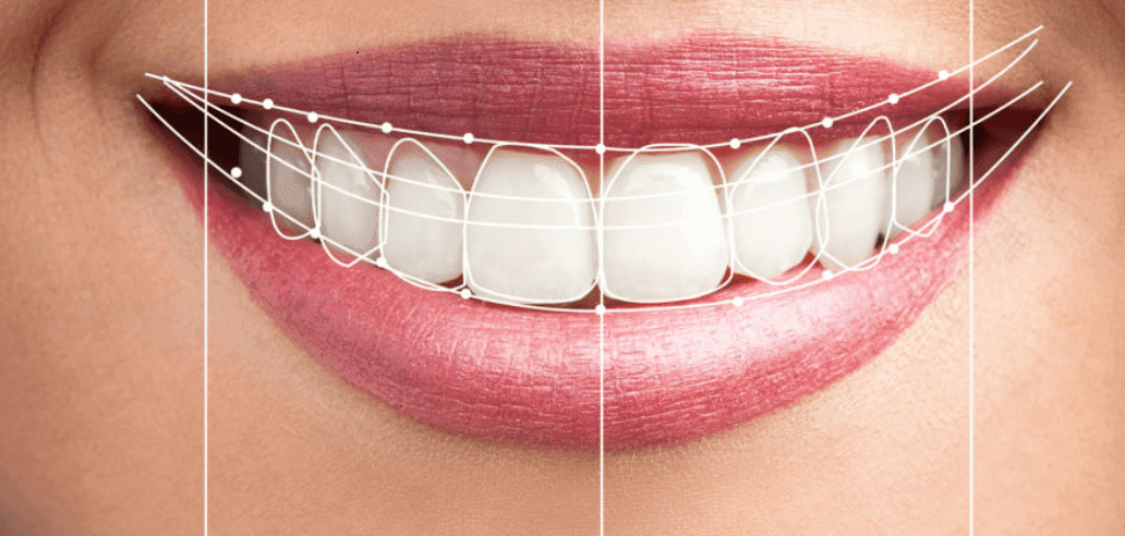 Perfectly aligned teeth with digital outlines.