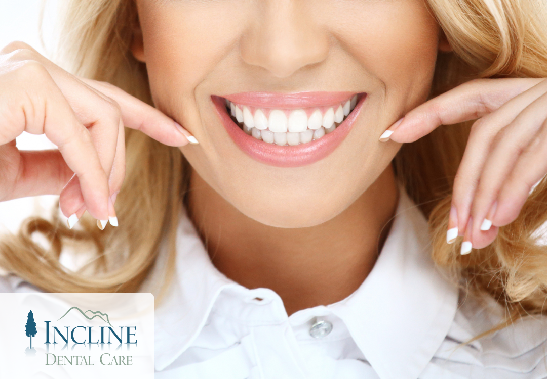 Smiling woman with white teeth, Incline Dental Care